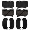 ACDelco 17D812M Disc Brake Pad Semi-Metallic Front Disc Brake Pad Set