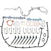 Alliant Power AP57000NP Fuel Injection System Repair Kit REM FUEL CONTAMINATION KIT